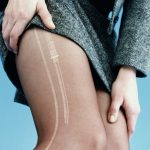 ffw-100515-run-in-stockings