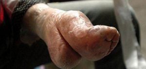 Táto hrozná tradícia je stará 1000 rokov! 20 šokujúcich fotografií čínskych „lotosových nôh“.