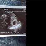 b920962c57e8a973899f59d0dbe119d5