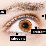 hypertyreoza-570×295