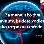 Za-menej-ako-dve-minúty-budete-vedieť-ako-rozpoznať-mŕtvicu (1)