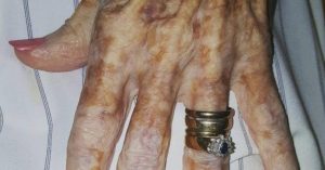 Táto starenka ju poprosila či by jej nevyčistila nechty. Ale to, čo urobila sestrička, zasiahlo celý internet!