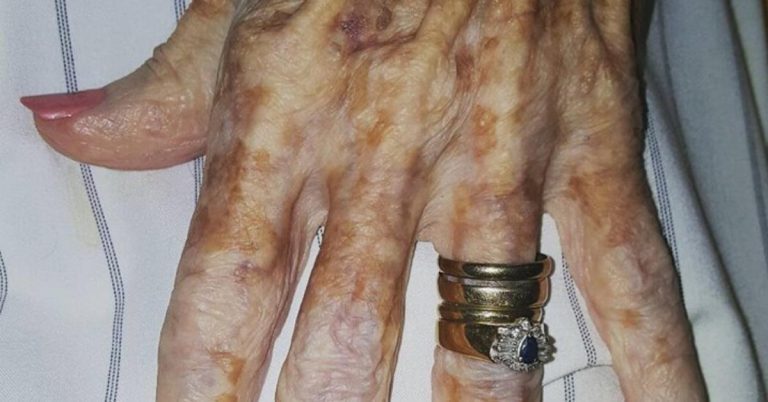 Táto starenka ju poprosila či by jej nevyčistila nechty. Ale to, čo urobila sestrička, zasiahlo celý internet!