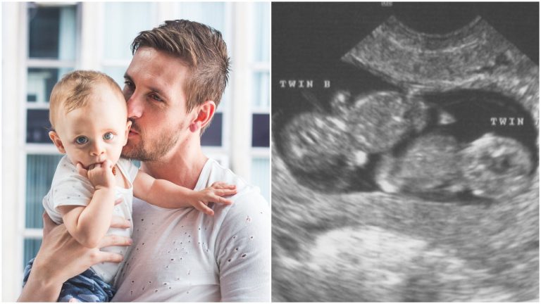Budúci otec naštval svoju ženu počas ultrazvuku: Kvôli tomuto s ním dva dni nerozprávala