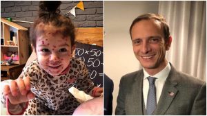 Politik a šéf kampane týkajúcej sa proti očkovaniu dostal ovčie kiahne. Teraz leží v nemocnici