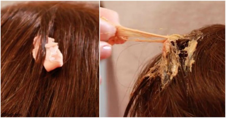 Tu je návod, ako odstrániť žuvačku z vlasov bez bolesti a straty