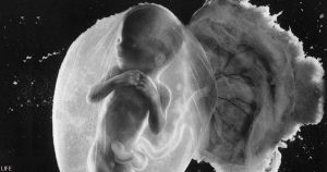 Snímka nenarodeného dieťaťa v 18. týždni tehotenstva sa stala fotografiou storočia