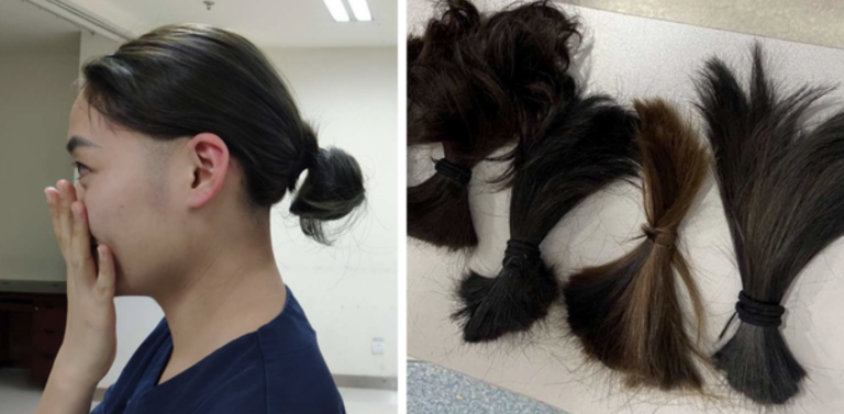 Čínske lekárky si kvôli Korona vírusu holia vlasy. Toto je dôvod