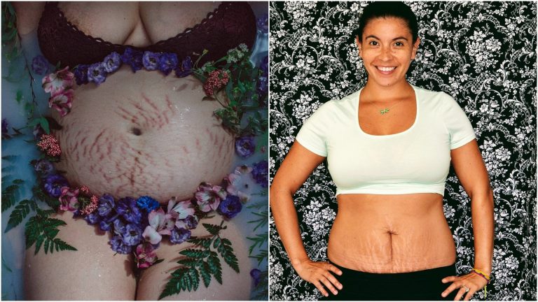 Toto sú skutočné fotografie mamičiek po pôrode. Ich telo je krásne v každom momente!