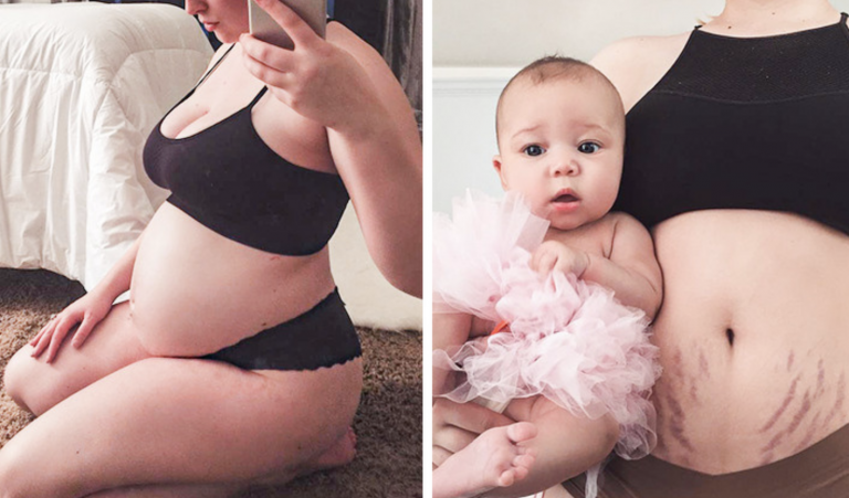 Krása materstva: 15 fotiek počas a po tehotenstve, ktoré dokazujú magickosť tohto obdobia