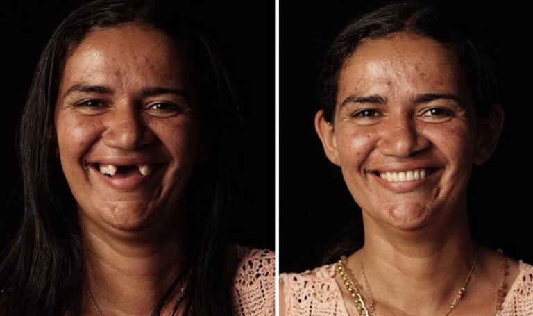 Brazílsky zubár cestuje po krajine a zadarmo opravuje ľudom zuby. Tí si ho za to veľmi obľúbili