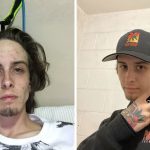 before-after-drug-addiction-recovery-jusalotofpain-coverimage