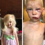 6-year-old-boy-saves-little-sister-from-dog-attack-fb2-png__700