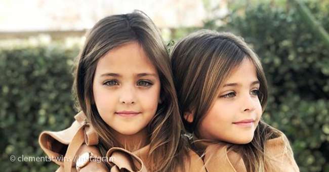 Toto sú najkrajšie dvojčatá na svete. Pozrite sa, ako vyrástli do krásy