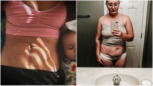 20 úprimných fotografií o tom, ako vyzerá ženské telo krátko po pôrode