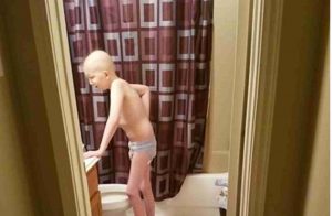 Mama uverejnila fotografiu svojho 10-ročného chorého syna v plienke. Jej slová vás chytia za srdce