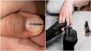 Nechtárka upozornila klientku na život ohrozujúci znak na jej nechtoch