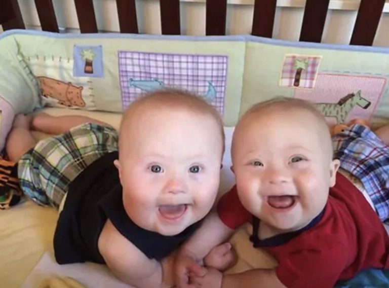 Dvojičky s Downovým syndrómom inšpirujú celý svet svojou láskou. Toto sme pre ne urobili, hovorí mama