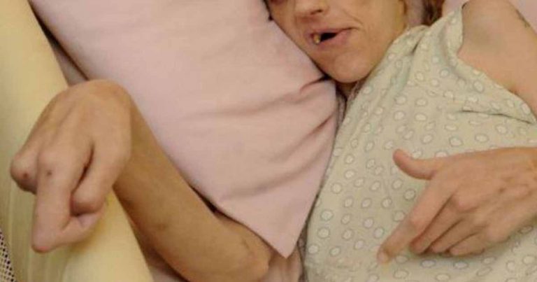 Pila 24 pív denne. Mala ledva 35 a vyzerala ako babička. Zomrela v mukách.