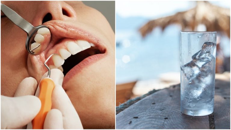 Zubár zdieľa desivý dôvod, prečo by ste nikdy nemali žuť ľad!