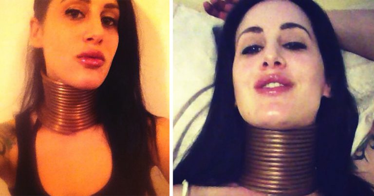 Žena strávila 5 rokov naťahovaním krku. Neuveríte, prečo to robila. Chcela vyzerať ako jedno zviera