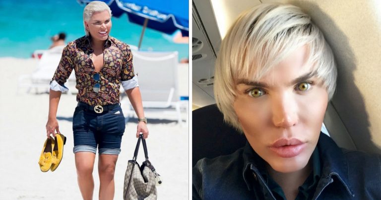 Hrôza, toto je žijúci Ken! To, ako vyzeral muž pred plastickými operáciami teraz ukázal svetu