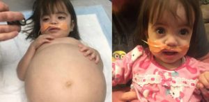 Dievčatko, ktoré vyzeralo ako v 8. mesiaci kvôli smrteľnej chorobe, bolo zachránené. TENTO MUŽ JEJ POMOHOL