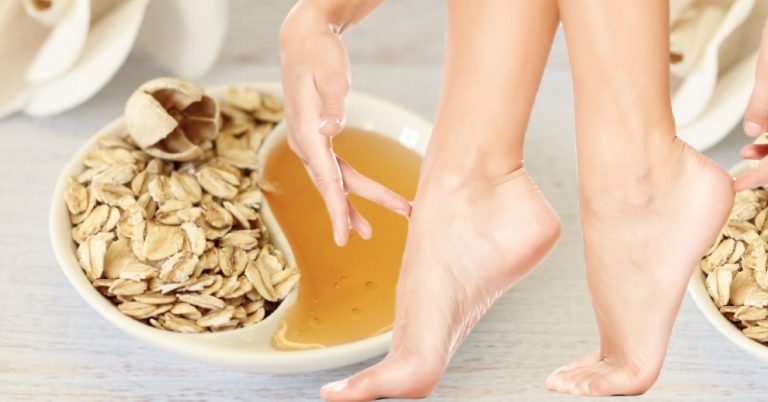 ZABUDNITE NA POPRASKANÉ päty. Pripravte svoje chodidlá na leto! TOTO POMÁHA