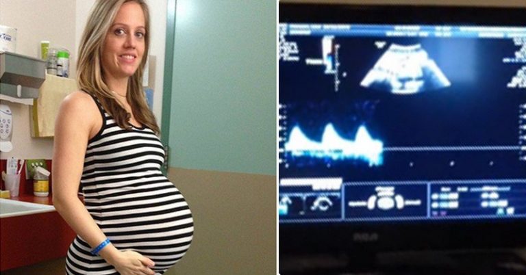 Povedali jej, že čaká dvojičky, neskôr jej však odporúčali, aby išla na potrat…