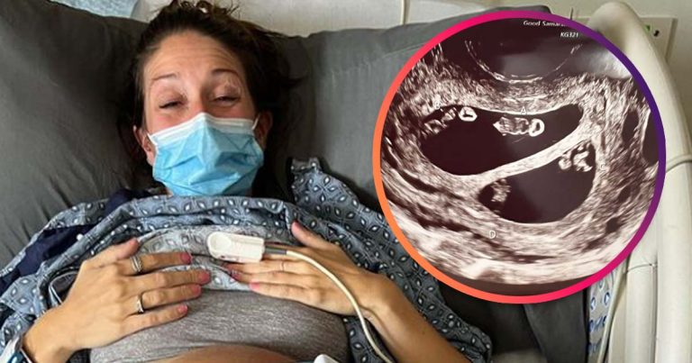 Keď jej lekári robili sono, neverili vlastným očiam. Pravdepodobnosť, že sa takýto prípad vyskytne, je 1:10 miliónov