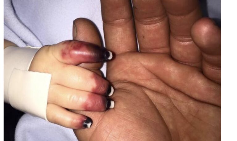 Rodičom povedali, že ich syn má infekciu ucha. Nakoniec skončil na pľúcnej ventilácii… LEBO..