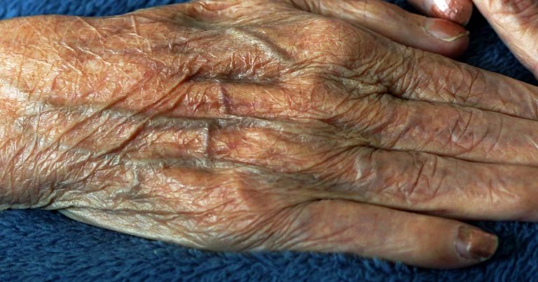 Prečo sú žily modré, keď nimi tečie červená krv? Odpoveď vás prekvapí.