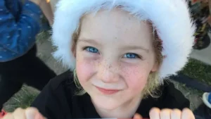 Dievča trpí zriedkavou chorobou. Jej vlasy sa nedajú rozčesať