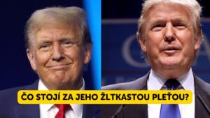Prečo má Donald Trump takú ŽLTKASTKÚ pleť a vlasy? Odborníci tvrdia, že by to mohLO BYŤ TOTO