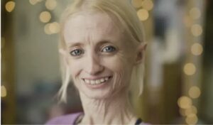 Má po 40-ke, ale vyzerá na 80-tku – Žena starne osemkrát rýchlejšie ako normálne