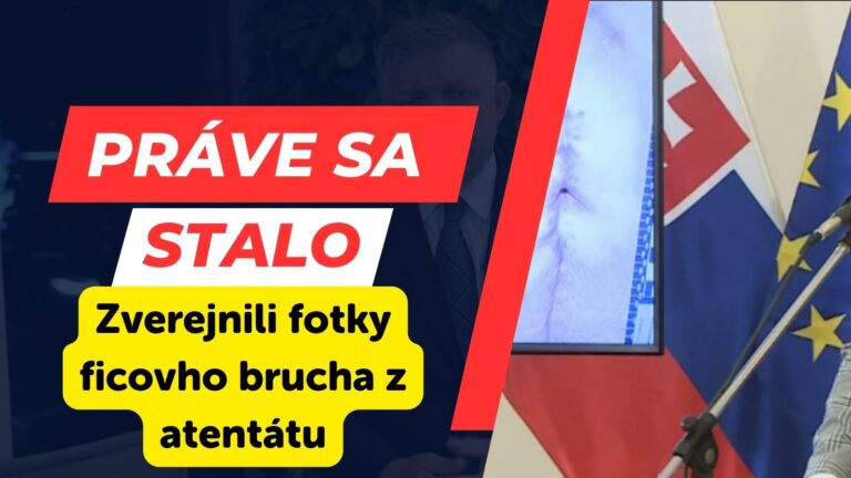 AKTUÁLNE: SMER zverejnil fotky Ficovho brucha po ATENTÁTE. „Obeťou nie je len premiér, ale celá spoločnosť.“ odkazujú