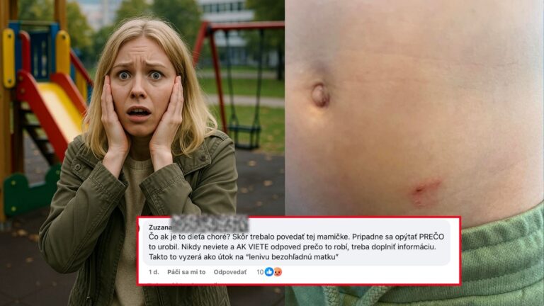 Mamička zdielala fotku svojho dieťaťa, ktoré UHRYZLO INÉ DIEŤA A UŠLO. TOTO Ľudia písali v komentoch