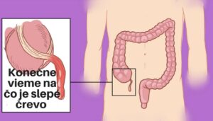 Vedecký prelom: Zistilo sa, prečo máme slepé črevo – odpoveď vás prekvapí!
