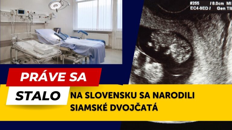 Slovensko sleduje MIMORIADNY prípad: V Bratislave sa narodili siamské dvojčatá! ČO čaká deti teraz?